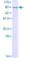 DAPK3 / ZIP Kinase Protein - 12.5% SDS-PAGE of human DAPK3 stained with Coomassie Blue
