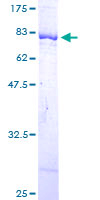 DARS Protein - 12.5% SDS-PAGE of human DARS stained with Coomassie Blue