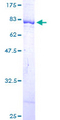 DARS Protein - 12.5% SDS-PAGE of human DARS stained with Coomassie Blue