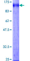 DATF1 / DIDO1 Protein - 12.5% SDS-PAGE of human DIDO1 stained with Coomassie Blue