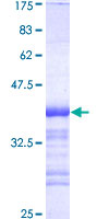DATF1 / DIDO1 Protein - 12.5% SDS-PAGE Stained with Coomassie Blue.