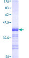 DATF1 / DIDO1 Protein - 12.5% SDS-PAGE Stained with Coomassie Blue.