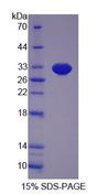 DATF1 / DIDO1 Protein - Recombinant  Death Inducer Obliterator 1 By SDS-PAGE