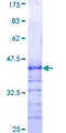 DAXX Protein - 12.5% SDS-PAGE Stained with Coomassie Blue.