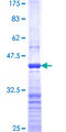 DAZ1 / DAZ Protein - 12.5% SDS-PAGE Stained with Coomassie Blue.