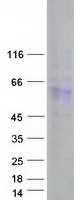 DAZ4 Protein - Purified recombinant protein DAZ4 was analyzed by SDS-PAGE gel and Coomassie Blue Staining