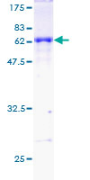 DAZL Protein - 12.5% SDS-PAGE of human DAZL stained with Coomassie Blue