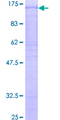 DBF4 Protein - 12.5% SDS-PAGE of human DBF4 stained with Coomassie Blue