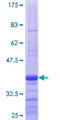 DBF4 Protein - 12.5% SDS-PAGE Stained with Coomassie Blue.