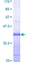 DBH/Dopamine Beta Hydroxylase Protein - 12.5% SDS-PAGE Stained with Coomassie Blue.