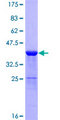DBI / ACBD1 Protein - 12.5% SDS-PAGE of human DBI stained with Coomassie Blue