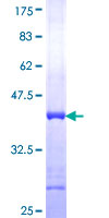 DBI / ACBD1 Protein - 12.5% SDS-PAGE Stained with Coomassie Blue.