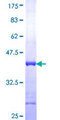 DBI / ACBD1 Protein - 12.5% SDS-PAGE Stained with Coomassie Blue.