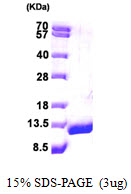 DBI / ACBD1 Protein