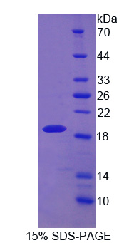 DBN1 / Drebrin Protein - Recombinant Drebrin 1 By SDS-PAGE