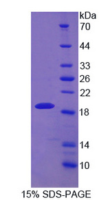 DBN1 / Drebrin Protein - Recombinant Drebrin 1 By SDS-PAGE