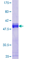 DBNDD1 Protein - 12.5% SDS-PAGE of human MGC3101 stained with Coomassie Blue