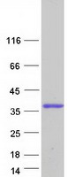 DBNDD2 Protein - Purified recombinant protein DBNDD2 was analyzed by SDS-PAGE gel and Coomassie Blue Staining