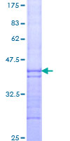 DBP5 / SON Protein - 12.5% SDS-PAGE Stained with Coomassie Blue.