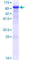 DBR1 Protein - 12.5% SDS-PAGE of human DBR1 stained with Coomassie Blue