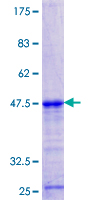 DBR1 Protein - 12.5% SDS-PAGE Stained with Coomassie Blue.