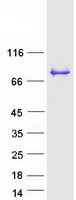 DBR1 Protein - Purified recombinant protein DBR1 was analyzed by SDS-PAGE gel and Coomassie Blue Staining