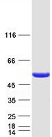 DBT / E2 Protein - Purified recombinant protein DBT was analyzed by SDS-PAGE gel and Coomassie Blue Staining