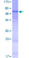 DCAF4L2 Protein - 12.5% SDS-PAGE of human WDR21C stained with Coomassie Blue