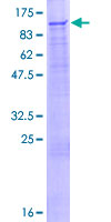 DCAF6 / NRIP Protein - 12.5% SDS-PAGE of human IQWD1 stained with Coomassie Blue