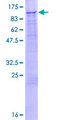 DCAF6 / NRIP Protein - 12.5% SDS-PAGE of human IQWD1 stained with Coomassie Blue