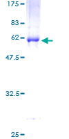 DCAF7 / WDR68 Protein - 12.5% SDS-PAGE of human HAN11 stained with Coomassie Blue