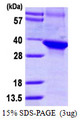 DCAF7 / WDR68 Protein