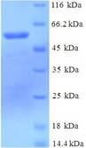 DCAF7 / WDR68 Protein