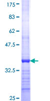DCAKD Protein - 12.5% SDS-PAGE Stained with Coomassie Blue.
