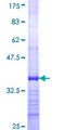 DCAKD Protein - 12.5% SDS-PAGE Stained with Coomassie Blue.