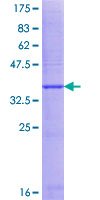 DCAL1 / CLECL1 Protein - 12.5% SDS-PAGE Stained with Coomassie Blue.