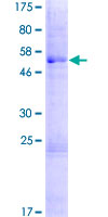 DCANP1 Protein - 12.5% SDS-PAGE of human C5orf20 stained with Coomassie Blue
