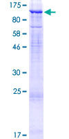 DCBLD2 Protein - 12.5% SDS-PAGE of human DCBLD2 stained with Coomassie Blue