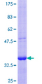 DCBLD2 Protein - 12.5% SDS-PAGE Stained with Coomassie Blue.