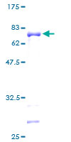 DCC1 / DSCC1 Protein - 12.5% SDS-PAGE of human DCC1 stained with Coomassie Blue
