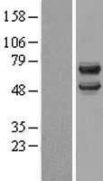 DCDC2 Protein - Western validation with an anti-DDK antibody * L: Control HEK293 lysate R: Over-expression lysate