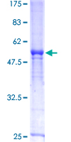 DCK / Deoxycytidine kinase Protein - 12.5% SDS-PAGE of human DCK stained with Coomassie Blue