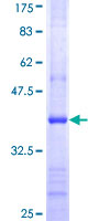 DCK / Deoxycytidine kinase Protein - 12.5% SDS-PAGE Stained with Coomassie Blue.