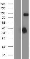 DCLK / DCLK1 Protein - Western validation with an anti-DDK antibody * L: Control HEK293 lysate R: Over-expression lysate