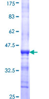 DCLK / DCLK1 Protein - 12.5% SDS-PAGE Stained with Coomassie Blue.
