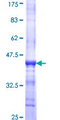 DCLK / DCLK1 Protein - 12.5% SDS-PAGE Stained with Coomassie Blue.