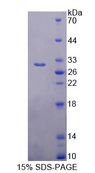 DCLK / DCLK1 Protein - Recombinant  Doublecortin Like Kinase 1 By SDS-PAGE