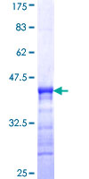 DCLK3 / CLR Protein - 12.5% SDS-PAGE Stained with Coomassie Blue.