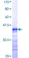 DCLK3 / CLR Protein - 12.5% SDS-PAGE Stained with Coomassie Blue.