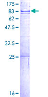 DCLRE1B Protein - 12.5% SDS-PAGE of human DCLRE1B stained with Coomassie Blue